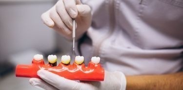 Kiedy wybrać implanty zębowe? Korzyści i wskazania do zabiegu