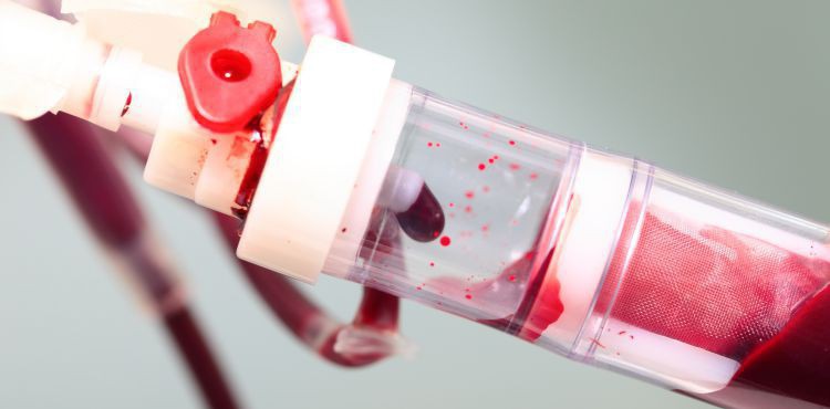 Przeszczepianie szpiku i komórek krwiotwórczych